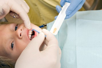 Boy getting fluoride varnish on teeth
